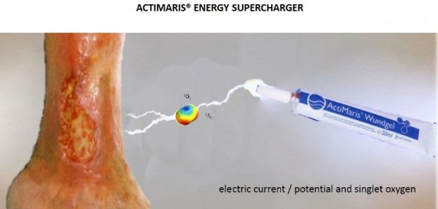 jakfunguje-actimaris-6