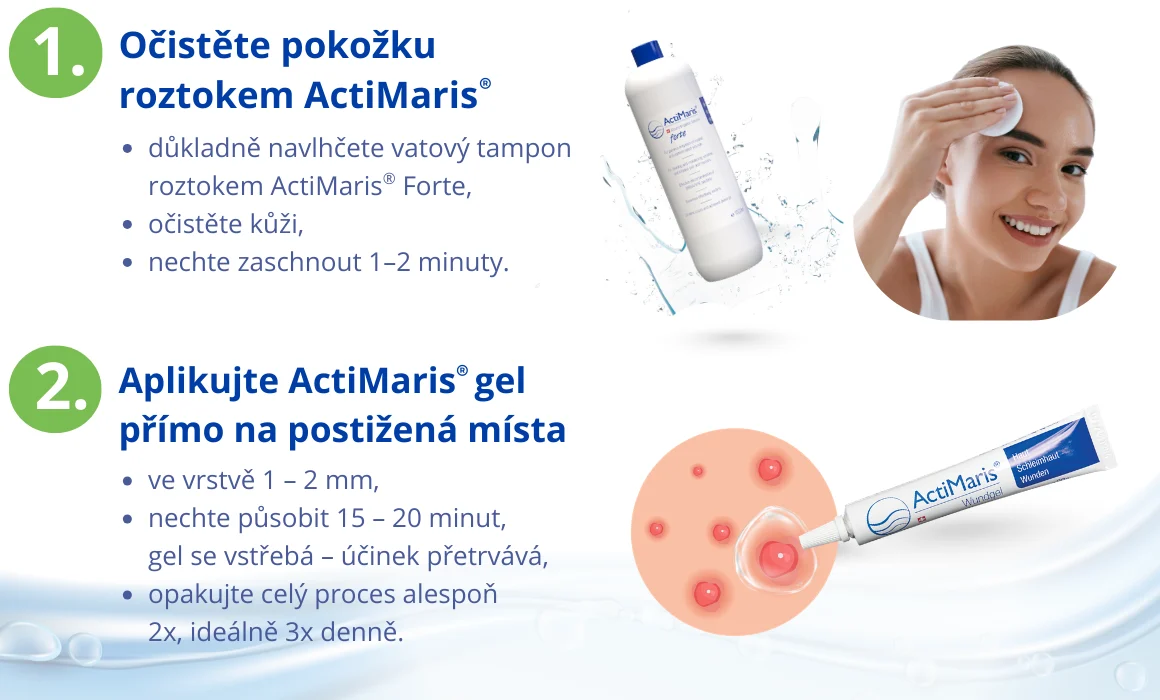 Postup při čištění pleti Actimaris roztokem a aplikace Actimaris Gelu