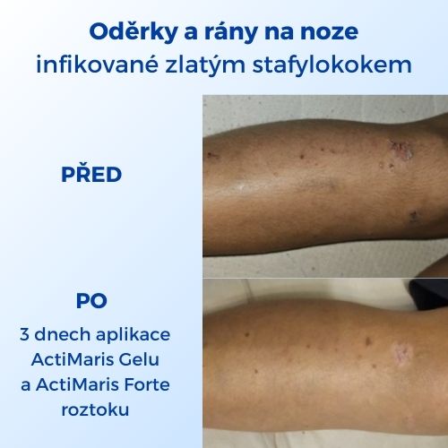 Oděrky