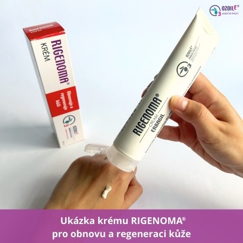 Ukázka velkého 100 ml krému rigenoma pro obnovu a regeneraci kůže na ruce.