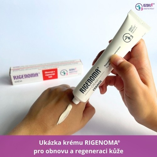 Ukázka malého 40 ml krému rigenoma pro obnovu a regeneraci kůže na ruce.