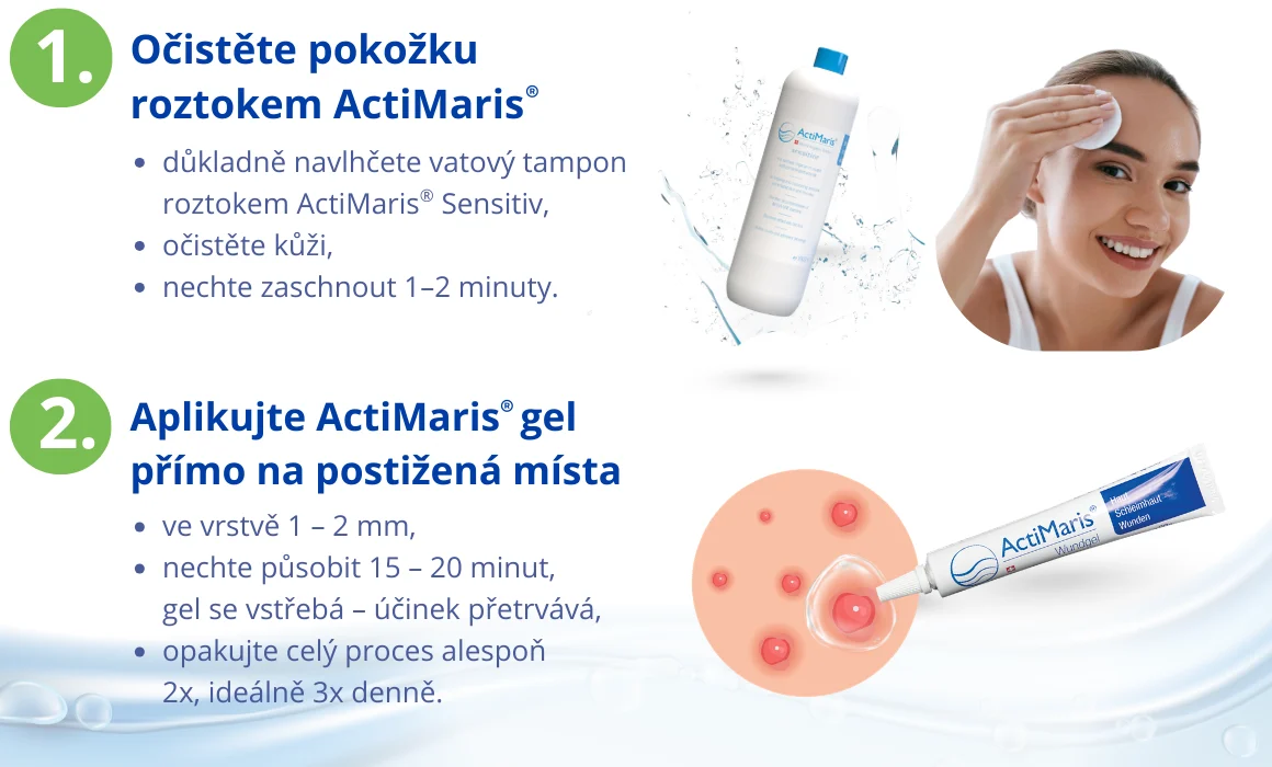 Postup při čištění pleti Actimaris roztokem a aplikace Actimaris Gelu