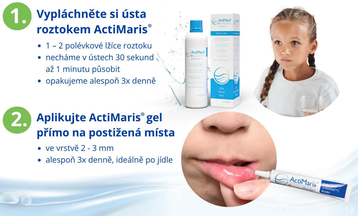 Postup při použití actimaris roztoku a gelu při problémy s afty