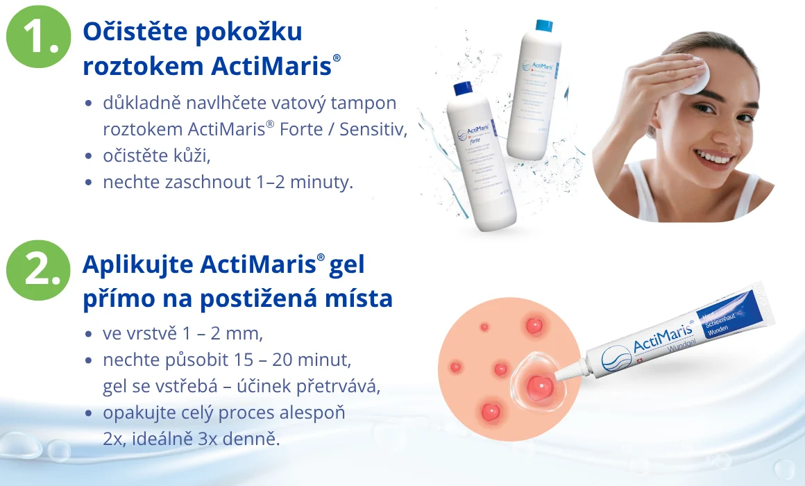 Postup při čištění pleti Actimaris roztokem a aplikace Actimaris Gelu