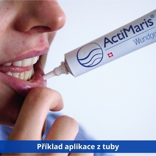 ActiMaris Gel aplikace na ret pomáhá při aftách