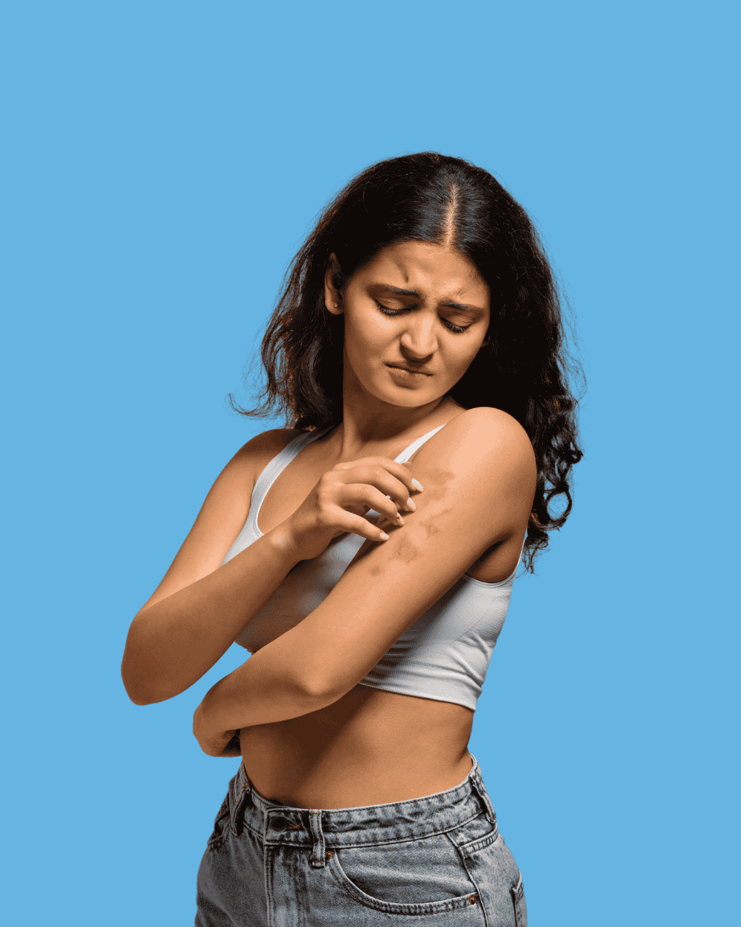 Žena trpící ekzémem na rukou si škrábe podrážděnou pokožku.