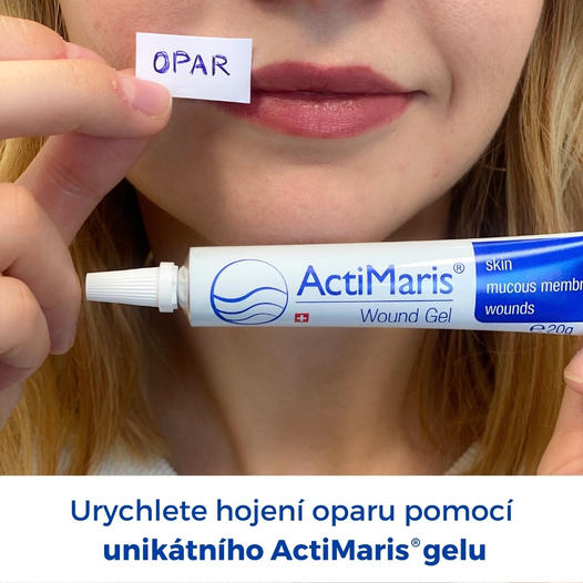 opar-actimaris Opary