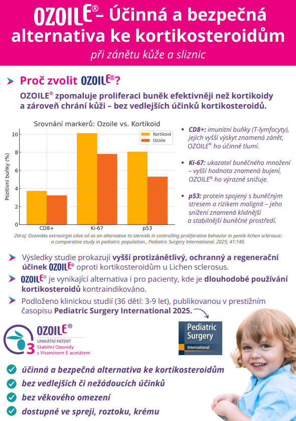 studie-ozoile-vs-kortikosteroidy studie-ouoile-vs-kortikosteroidy