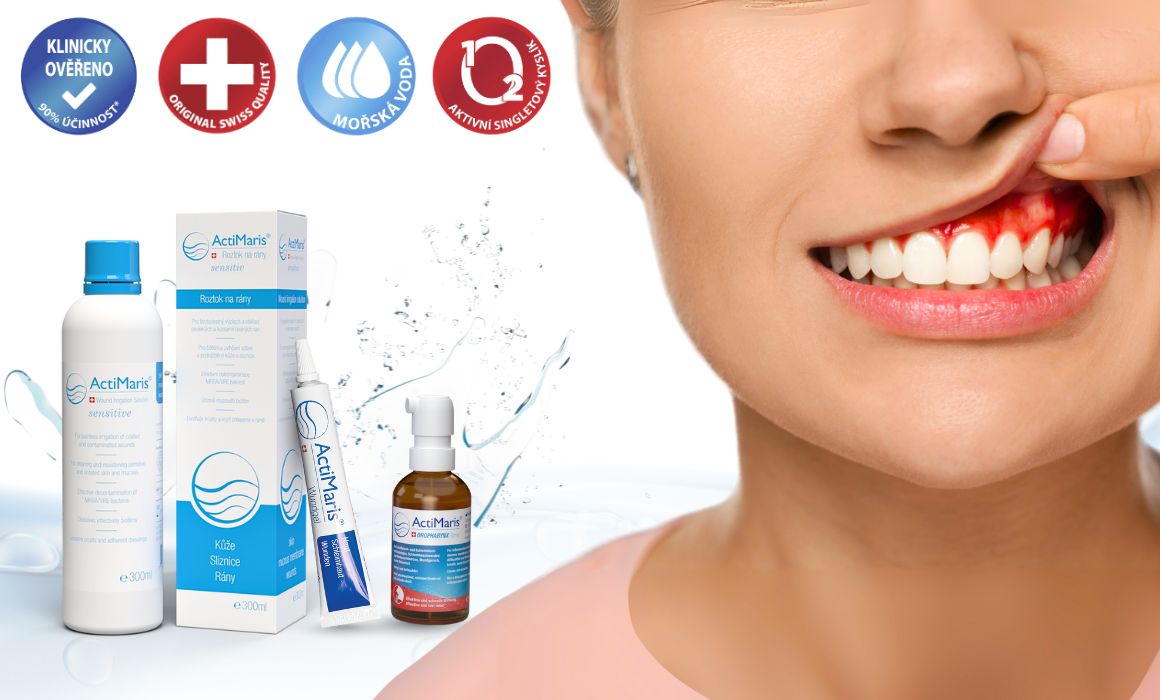 produkty actimaris pomáhají léčit zánět dásní